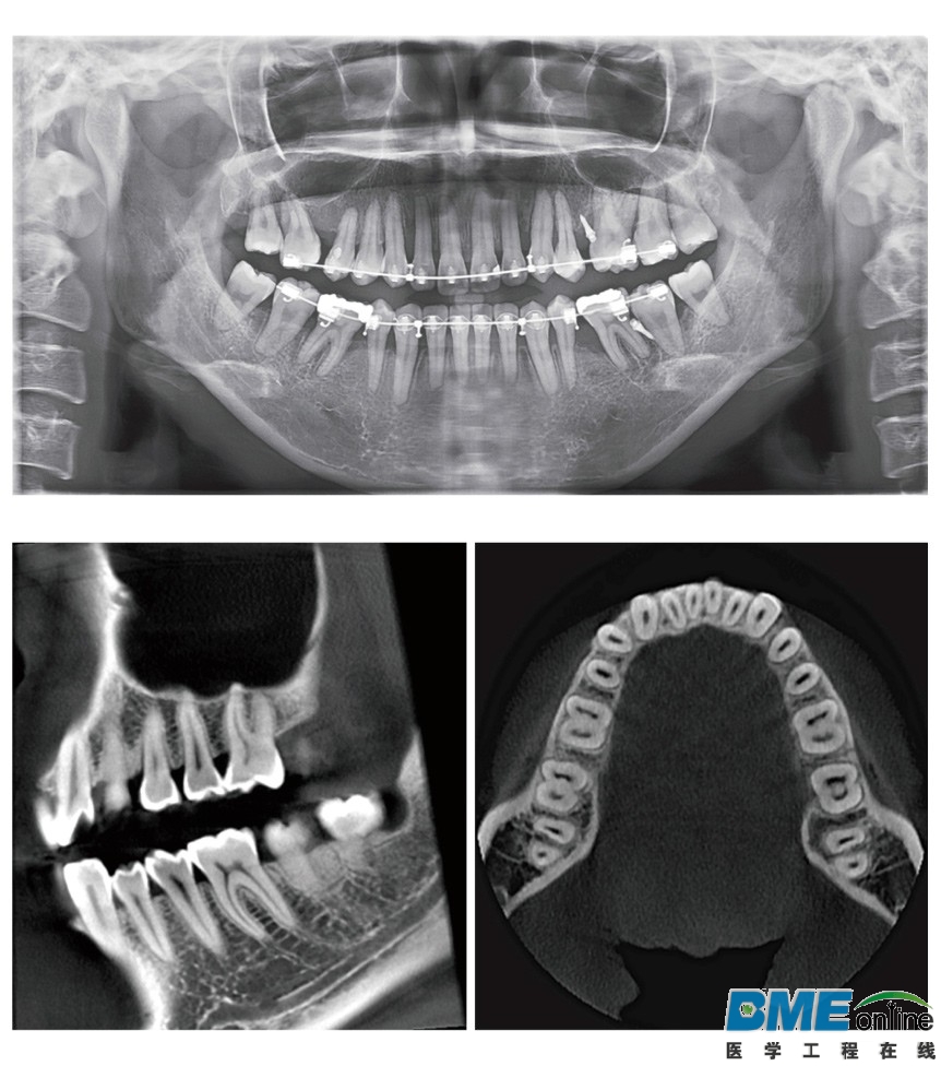 三星Rayscan α系列三合一CBCT1.jpg
