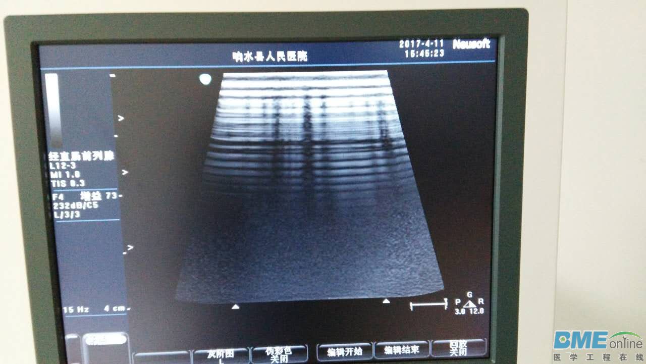 旧探头.jpg