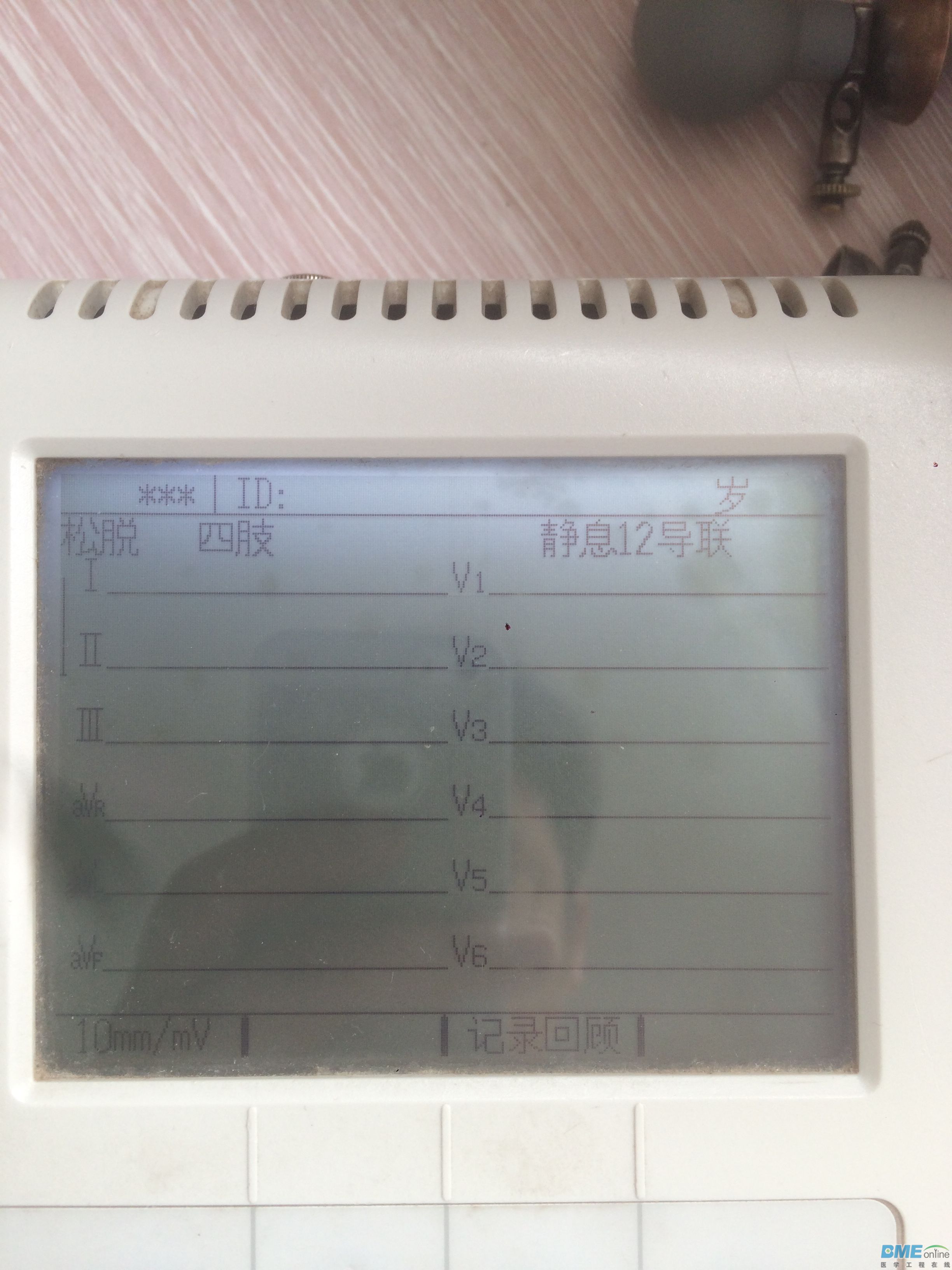 加上胸导联后
