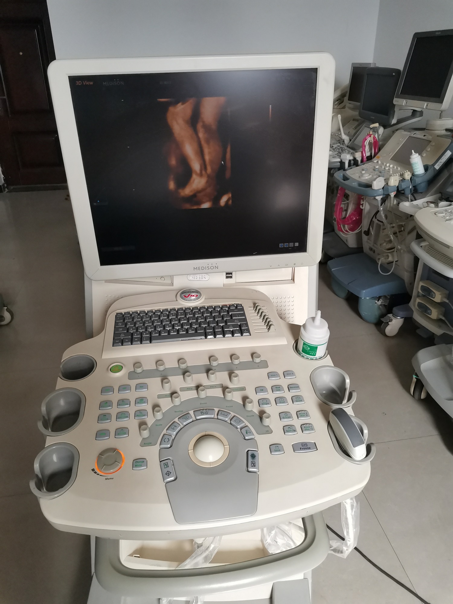 麦迪逊X8.V10四维彩超