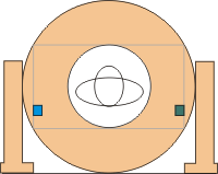 1代CT