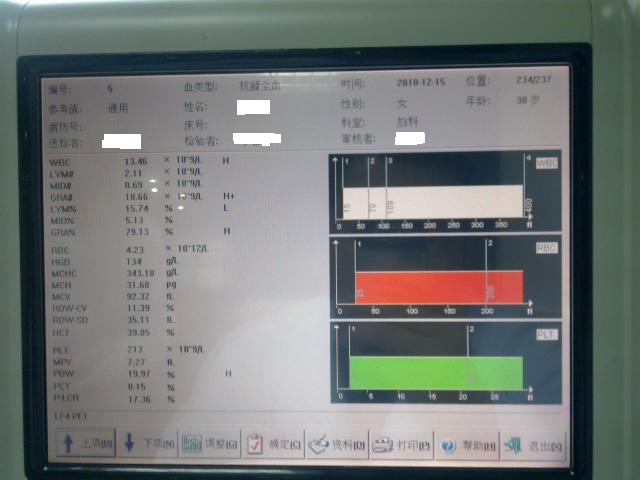 abbr_c73bf6ca2e53ef2c309183cb92b599d9.jpg